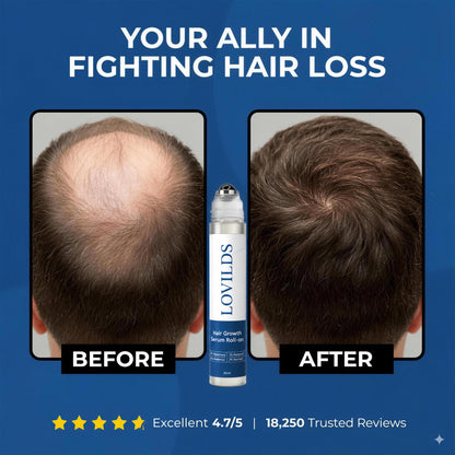 Hair Growth Roll-On Serum